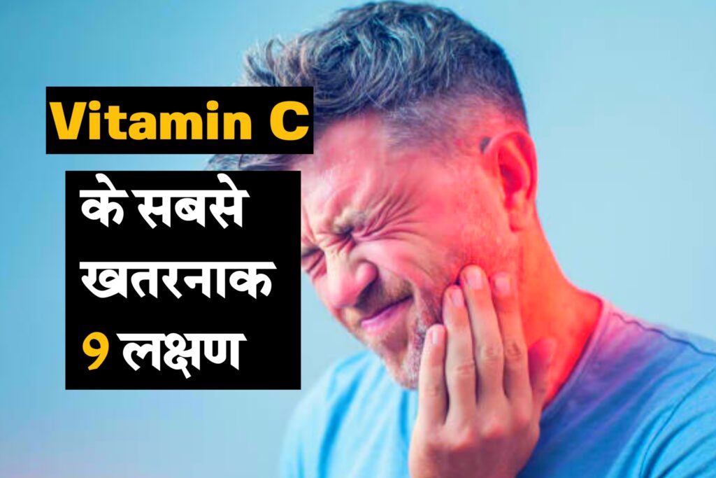 Vitamin C Ki Kami Ke Lakshan |