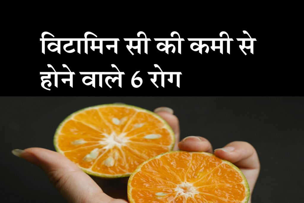 vitamin c ki kami se hone wale rog